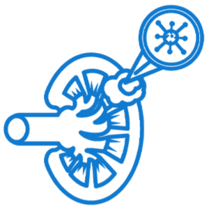 أورام الكلى