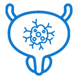 أورام المثانة