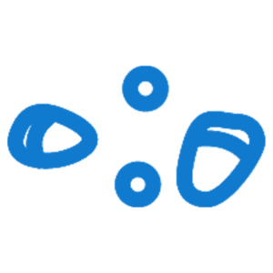 تفتيت الحصوات بالليزر